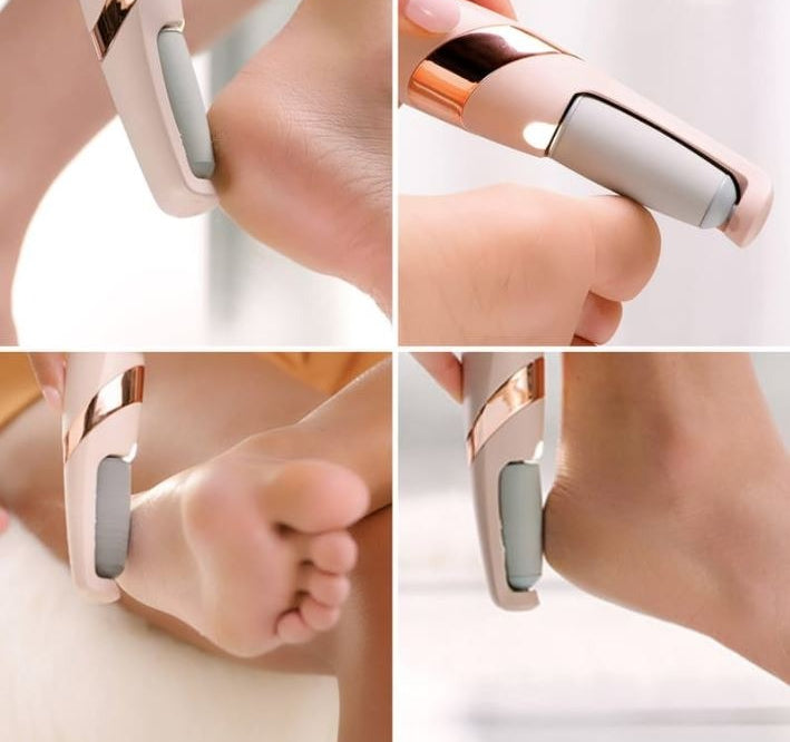 Rechargable Foot Filer Effective Callus Remover For Soft Smooth Feet With Easy